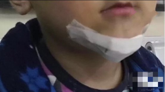 模仿抖音弄伤弟弟是模仿了什么 抖音应该背锅吗