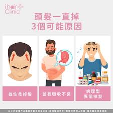 一直掉头发很厉害怎么解决