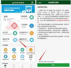 北京协和app怎么查诊断结果