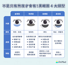 黑眼圈是因为睡眠不足吗