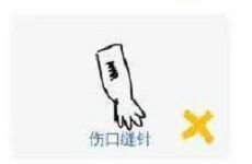谷歌猜画小歌微波炉伤口缝针灯笼怎么画?